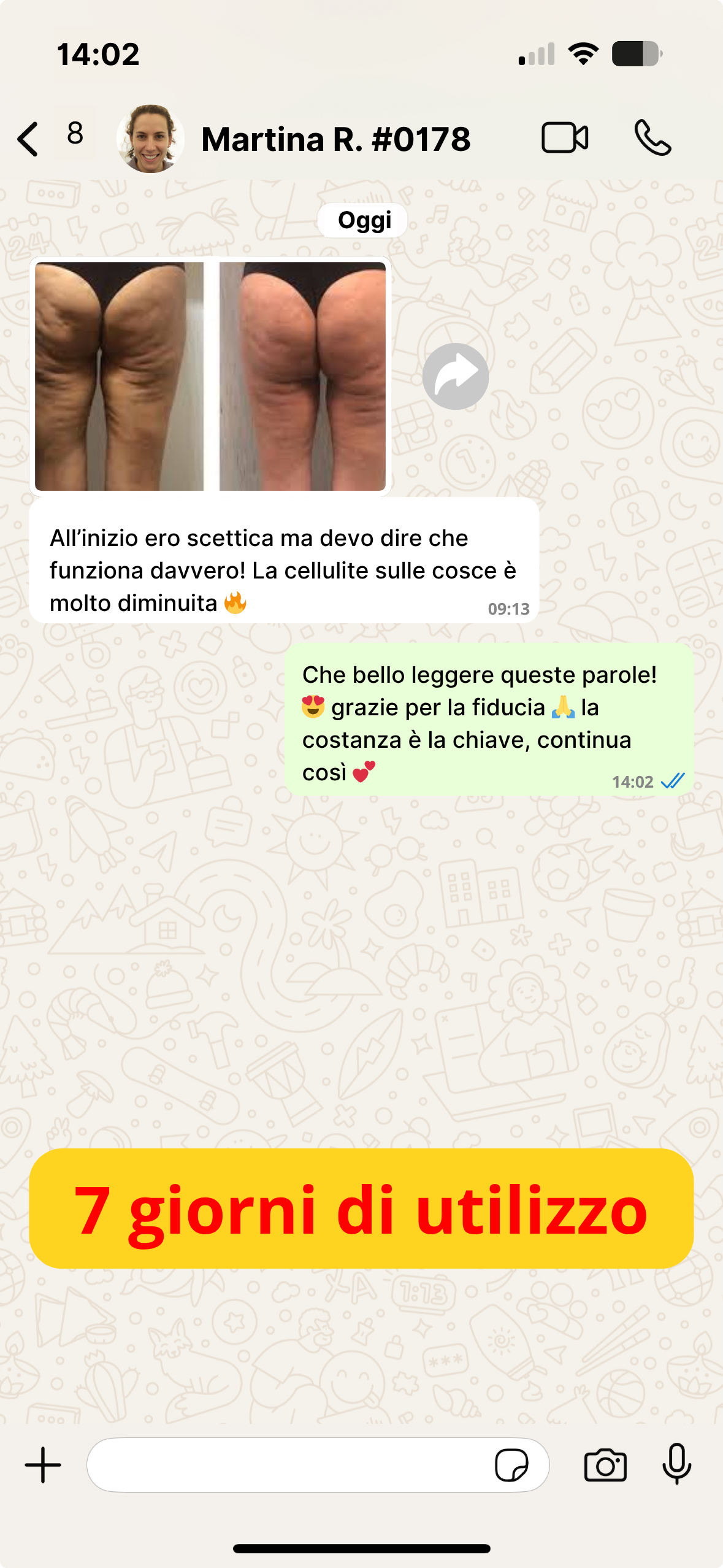 Cellulite IT (2)