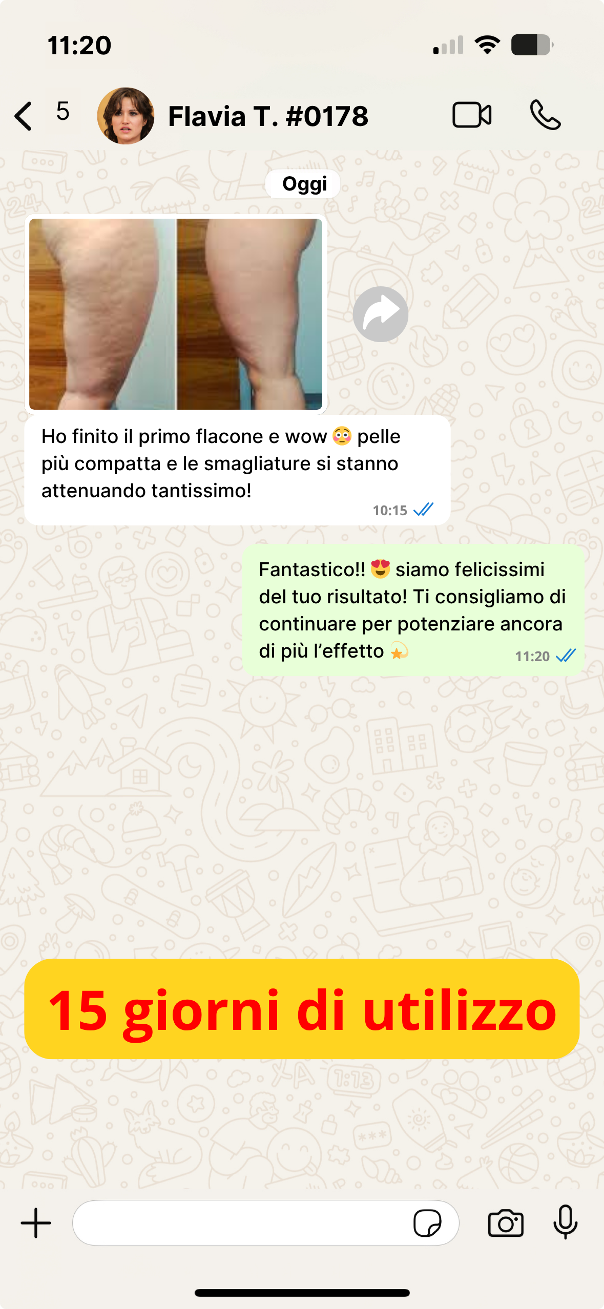 Cellulite IT (3)
