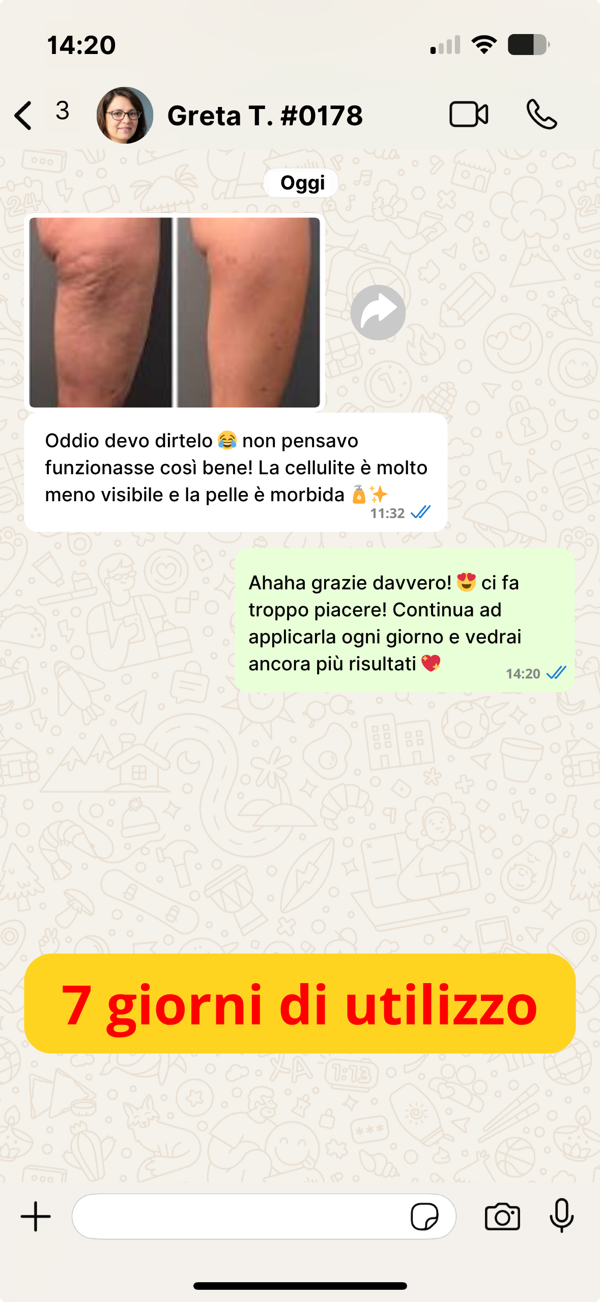 Cellulite IT (5)